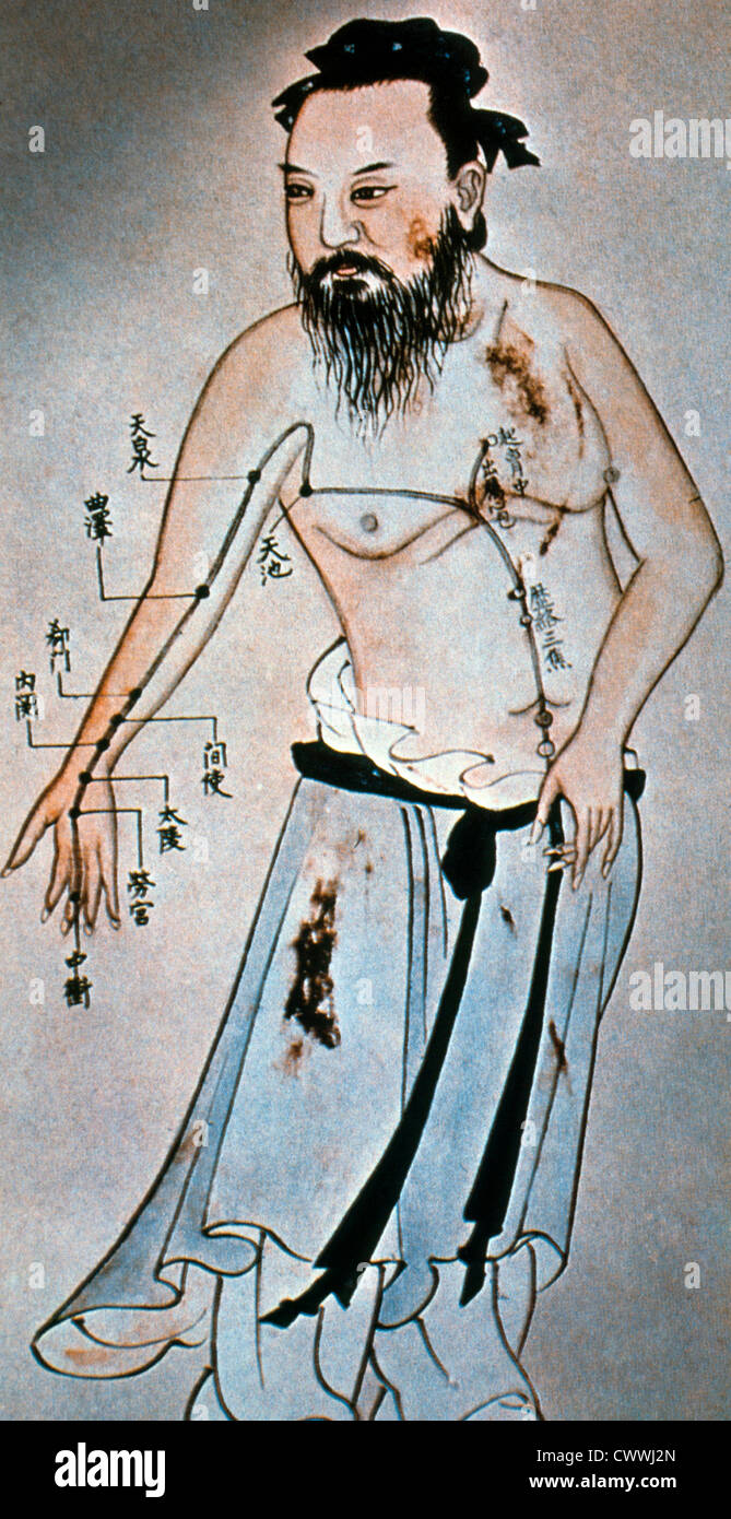 Anatomia cinese disegno da Trong Jin Tchou che mostra i punti di agopuntura sul braccio, 1031 Foto Stock
