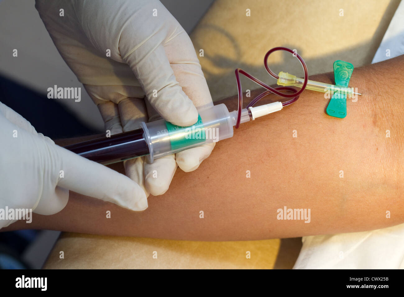 Analisi del sangue Foto Stock