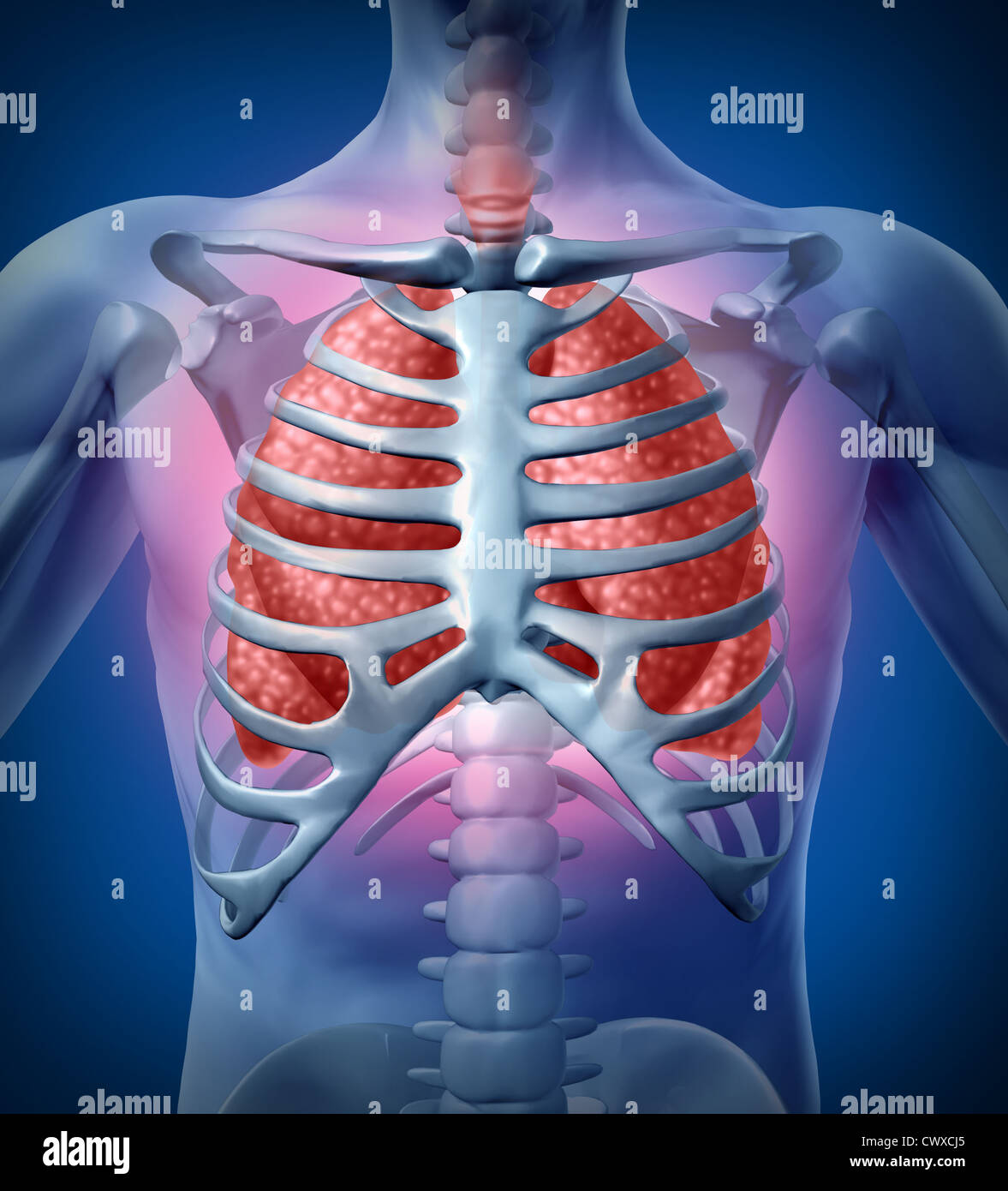 I polmoni umani infezione Illustrazione medica con un corpo scheletro in X-Ray vedendo all'interno dell'interno anatomico organo respiratorio che è affetta da polmonite o un virus pericoloso come una cura di salute concetto. Foto Stock