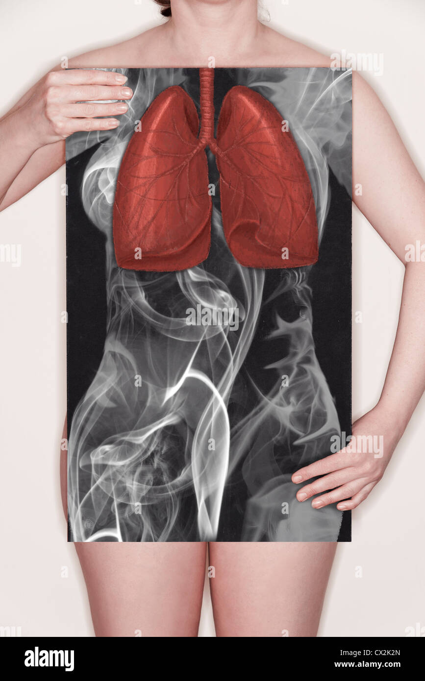 Donna che mantiene una lavagna con un'illustrazione dei polmoni disegnati di gesso e di un contorno del corpo costituito dal fumo. Concetto di immagine Foto Stock