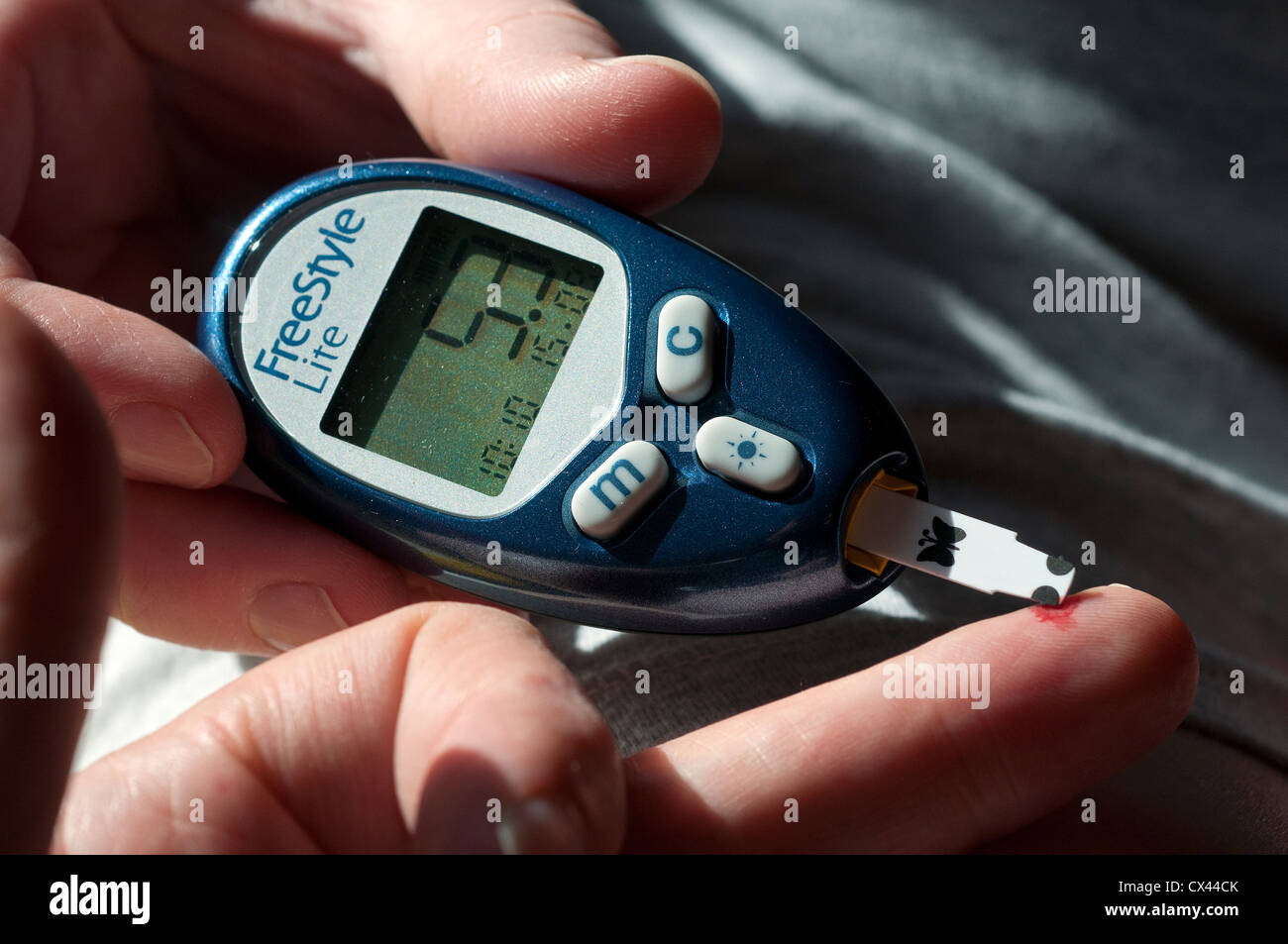 Il diabete mellito o semplicemente di diabete è un gruppo di malattie metaboliche in cui una persona ha livelli elevati di zucchero nel sangue Foto Stock Il diabete mellito o semplicemente di diabete è un gruppo di malattie metaboliche in cui una persona ha livelli elevati di zucchero nel sangue Foto Stock