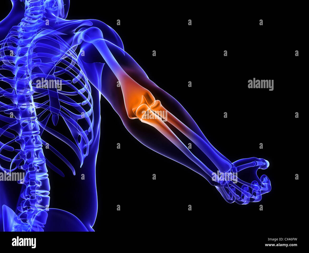 Rendering 3d Illustrazione medica di una borsite Foto Stock