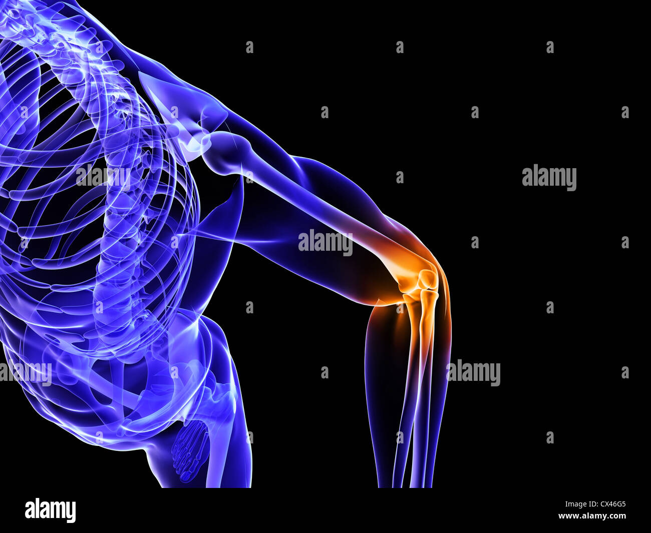 Rendering 3d Illustrazione medica di una borsite Foto Stock