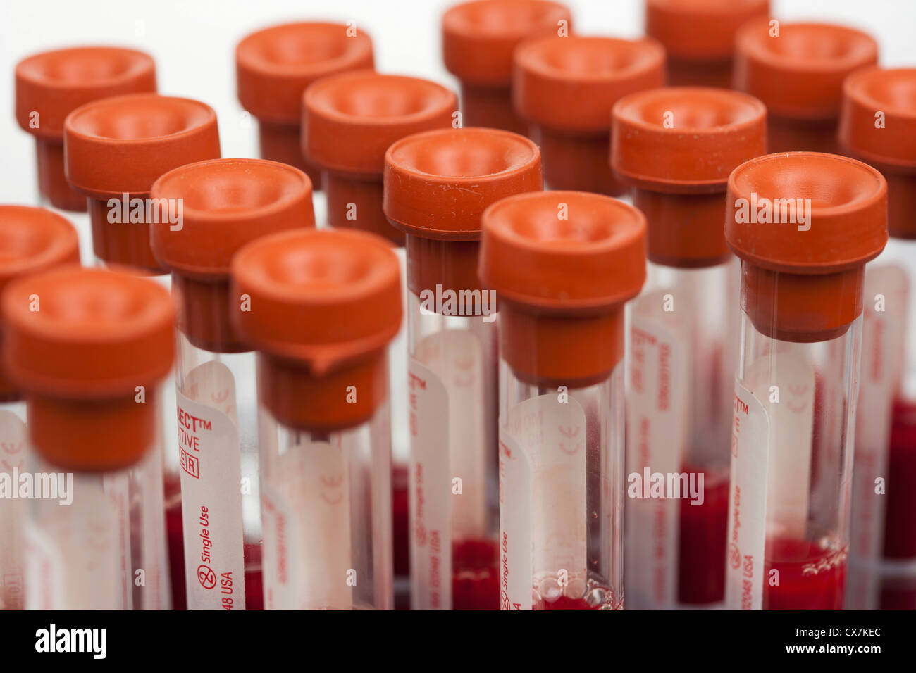 I campioni di sangue in tubi di prova Foto Stock