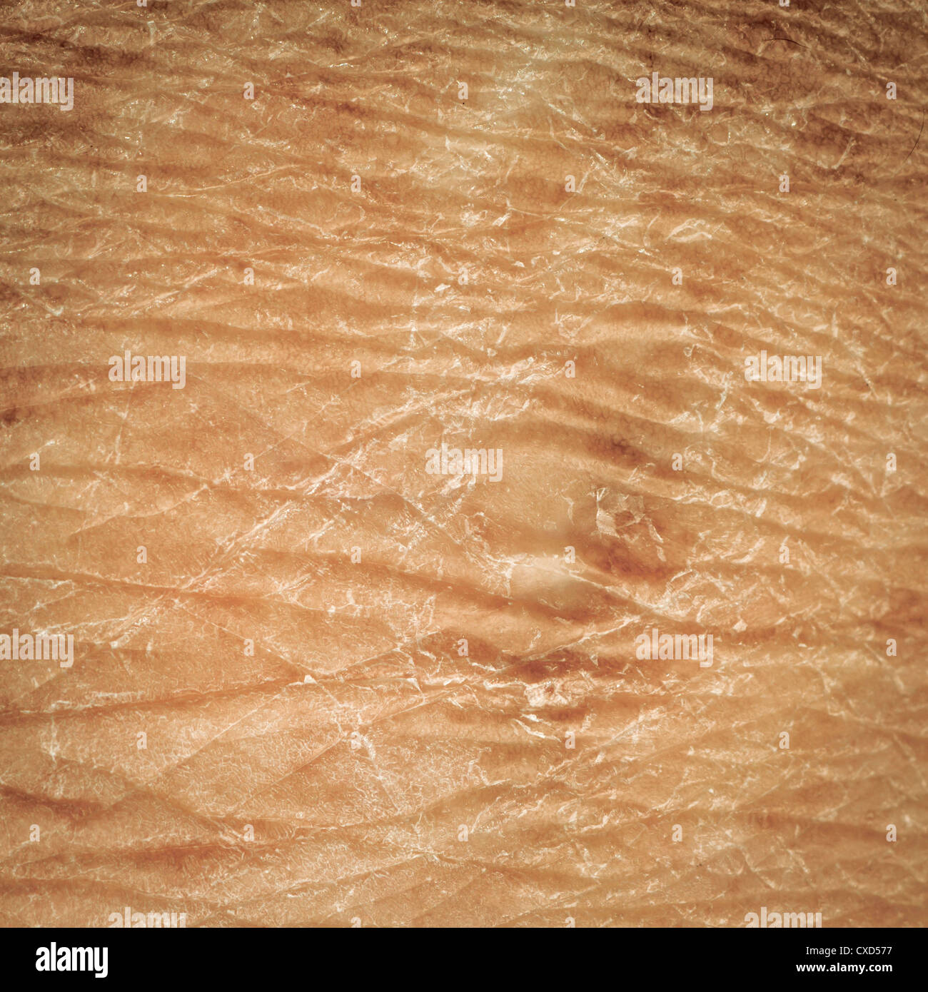 La pelle secca dettaglio texture di umana Foto Stock