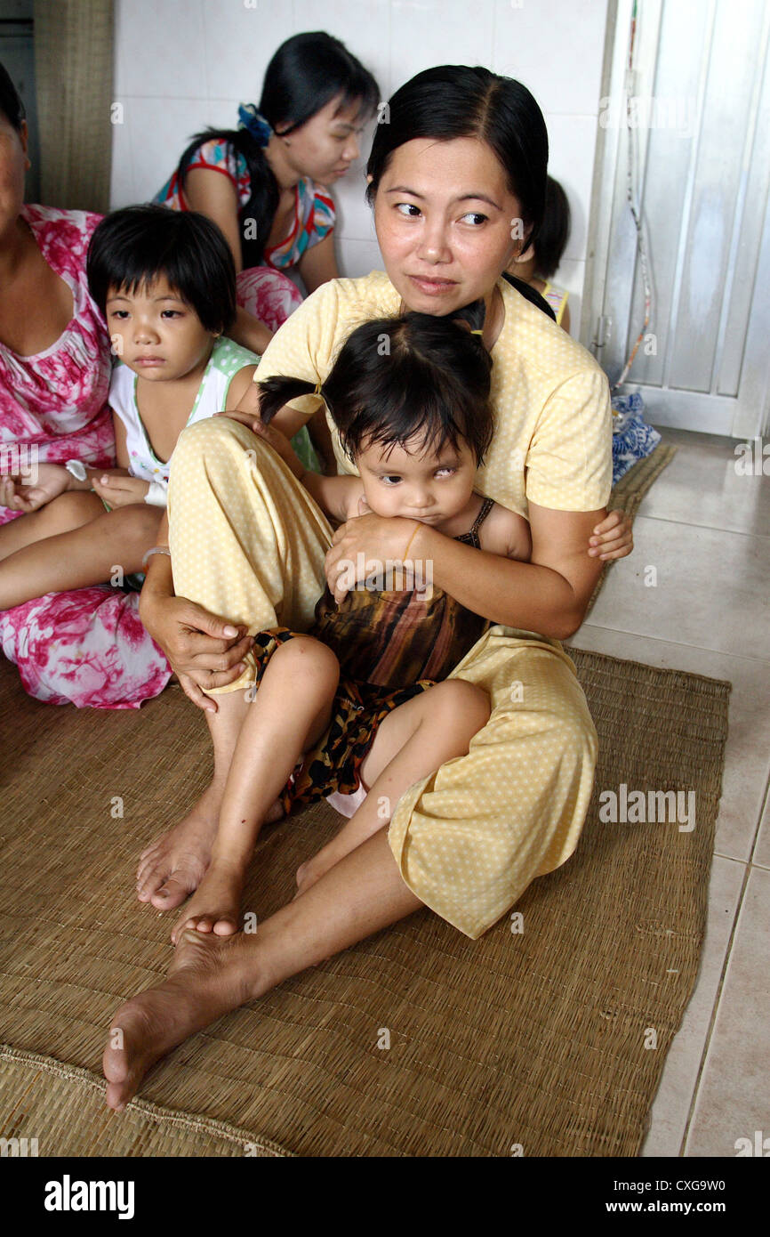 I bambini del cancer ward nella città di Ho Chi Minh Foto Stock