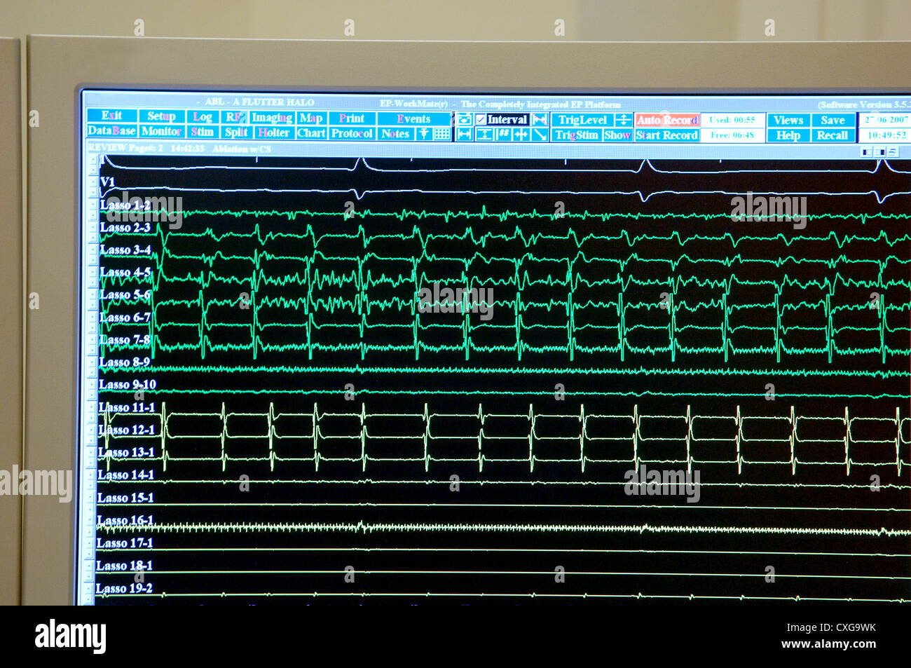Berlino, German Heart Center Foto Stock
