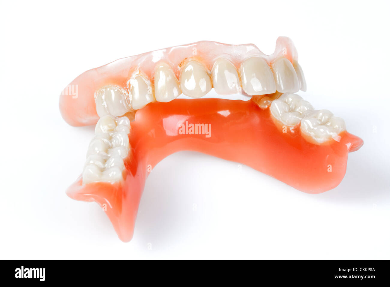 Protesi parziale, Zahn-Teilprothese Foto Stock