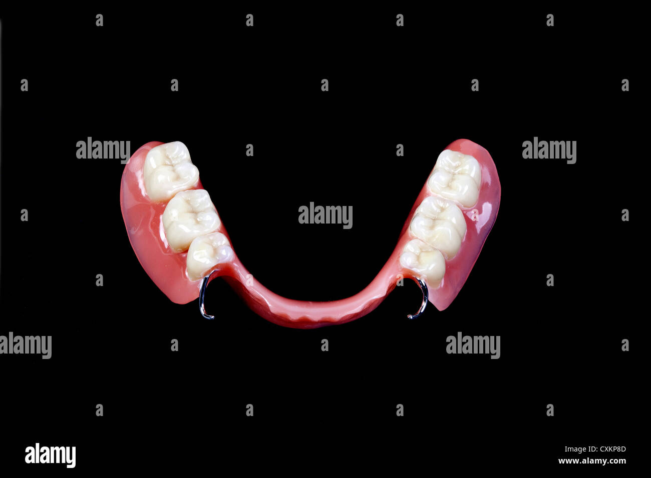 Protesi parziale, Zahn-Teilprothese Foto Stock