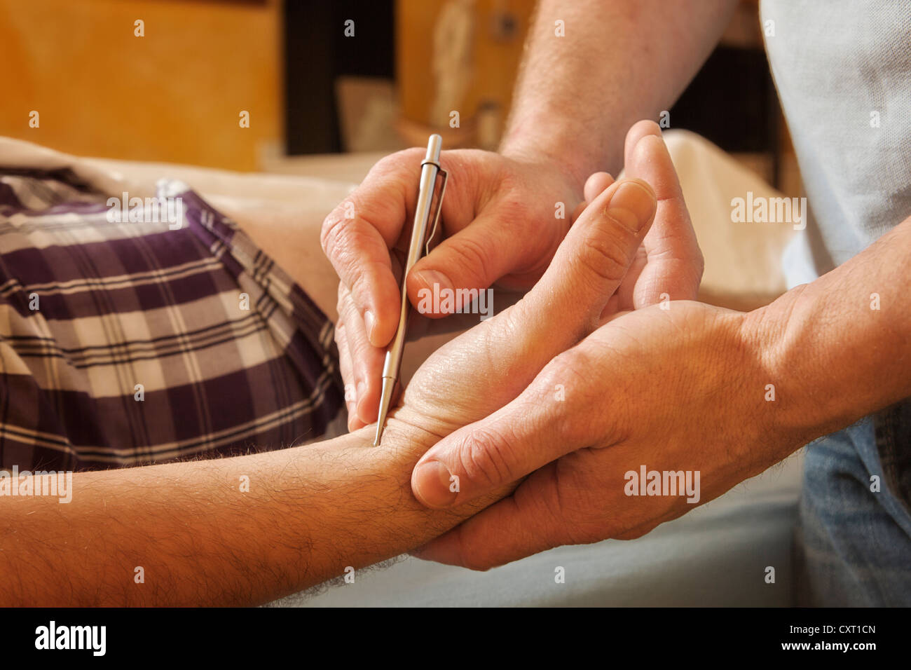 TCM, Medicina Tradizionale Cinese, stimolazione dei meridiani Foto Stock