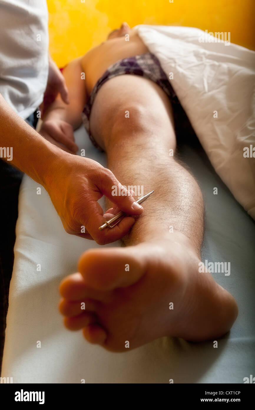 TCM, Medicina Tradizionale Cinese, stimolazione dei meridiani Foto Stock