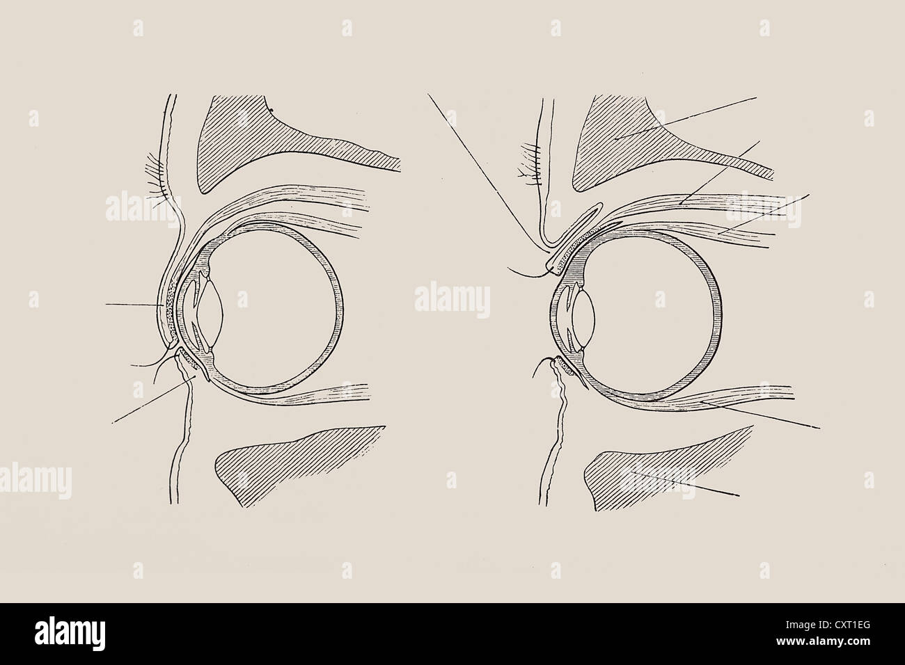 Vista in sezione dell'occhio umano, illustrazione anatomica Foto Stock
