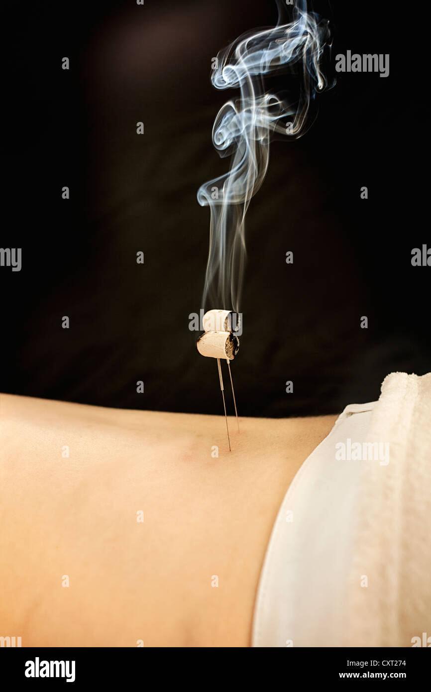 Moxa terapia, Moxibustione, Medicina Tradizionale Cinese Foto Stock