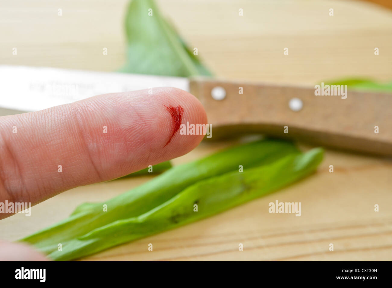 Lo spurgo del dito indice, lacerazione con un coltello da cucina, incidente domestico Foto Stock