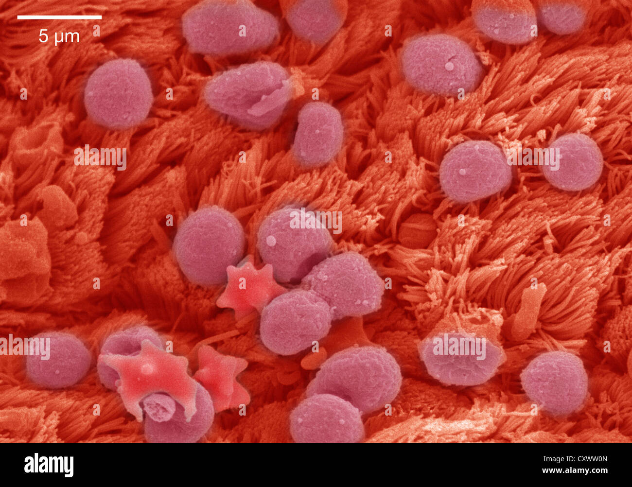 Micrografia elettronica a scansione di epitelio polmonare Foto Stock