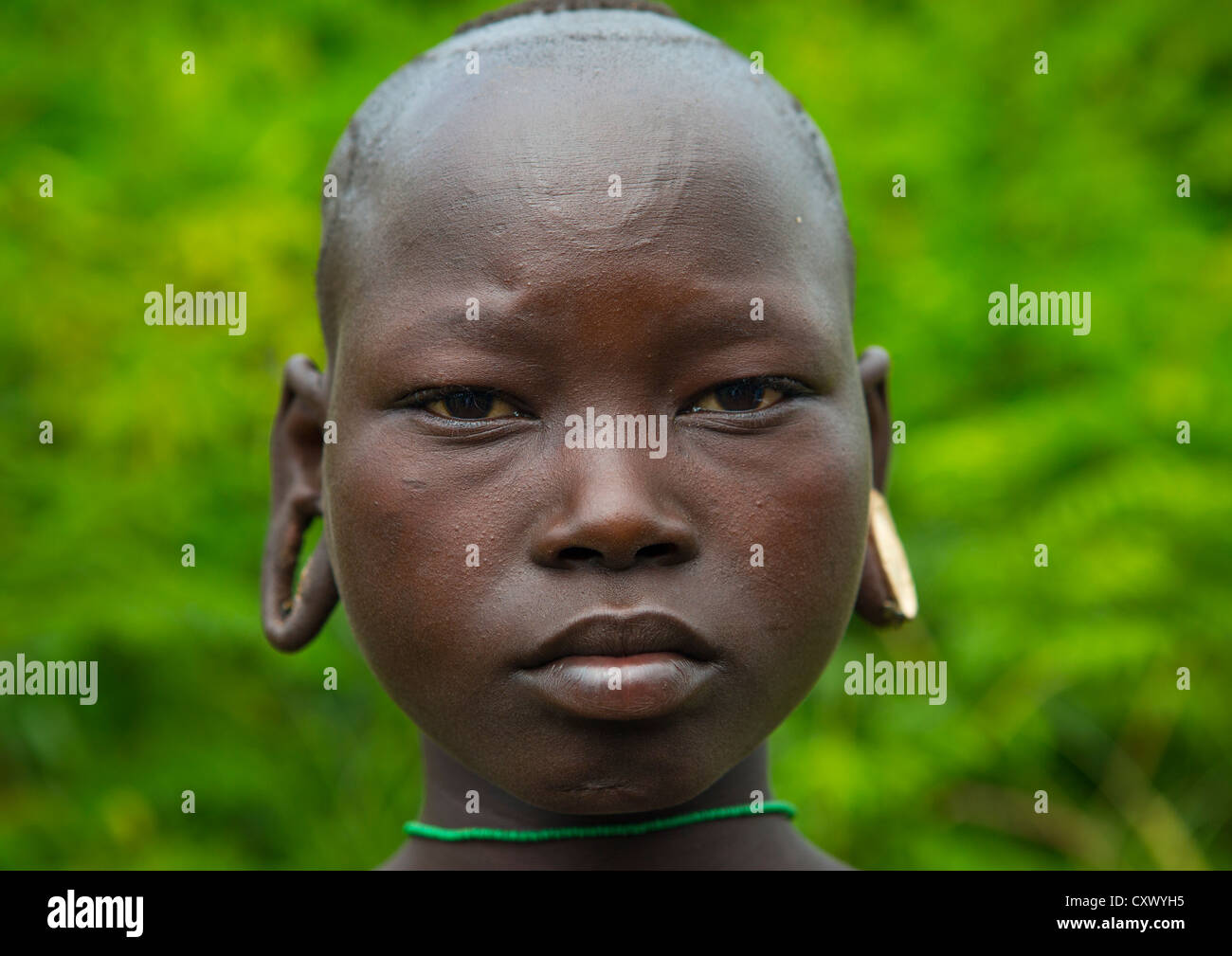 Close-up verticale di una tribù Suri Ragazza con orecchioni allargata durante una cerimonia di scarificazione, Tulgit, Valle dell'Omo, Etiopia Foto Stock