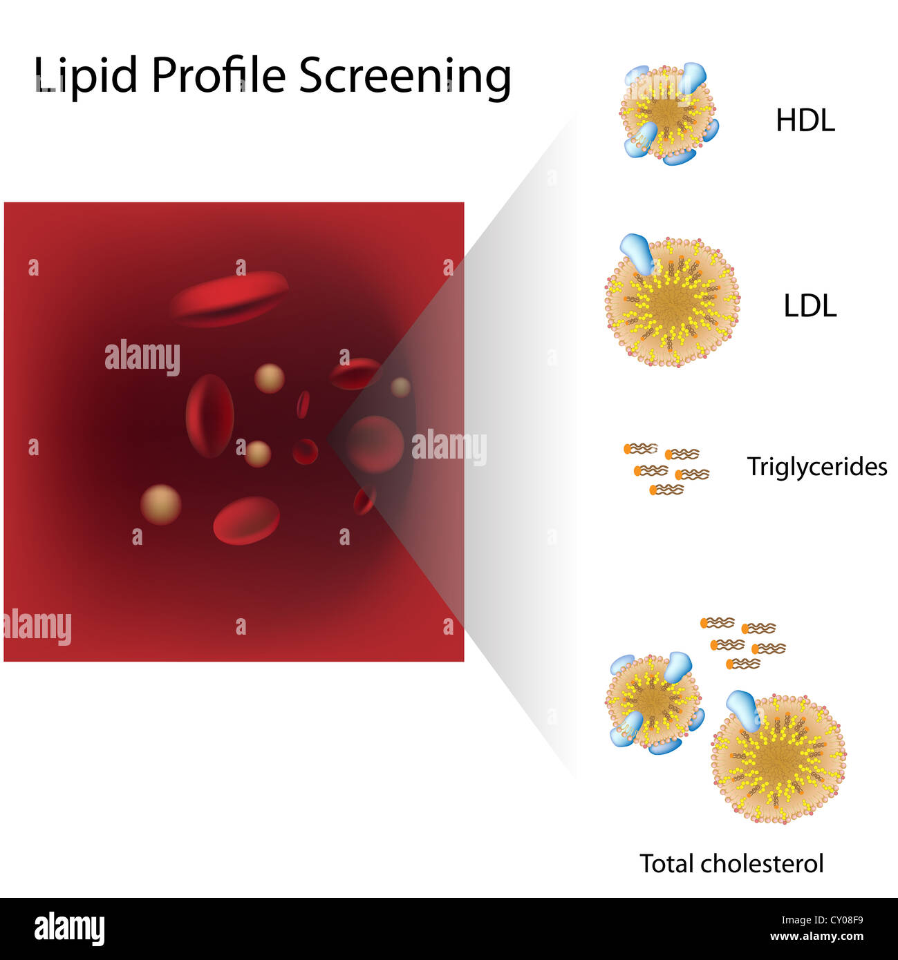 Profilo lipidico test del sangue Foto Stock