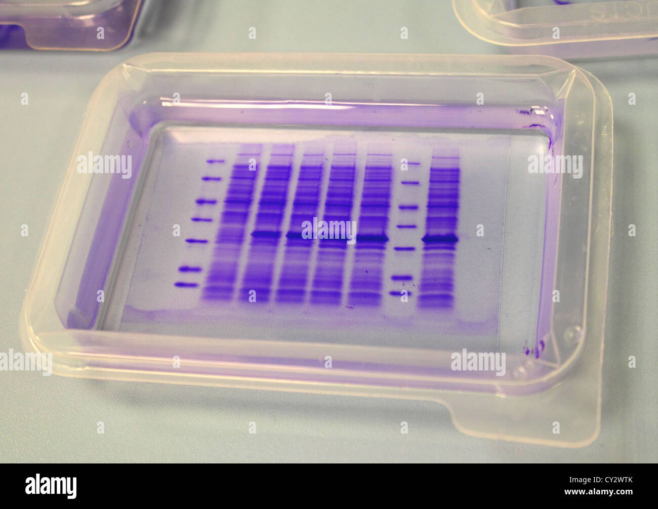 Gel proteici colorati blu Coomassie Foto stock - Alamy