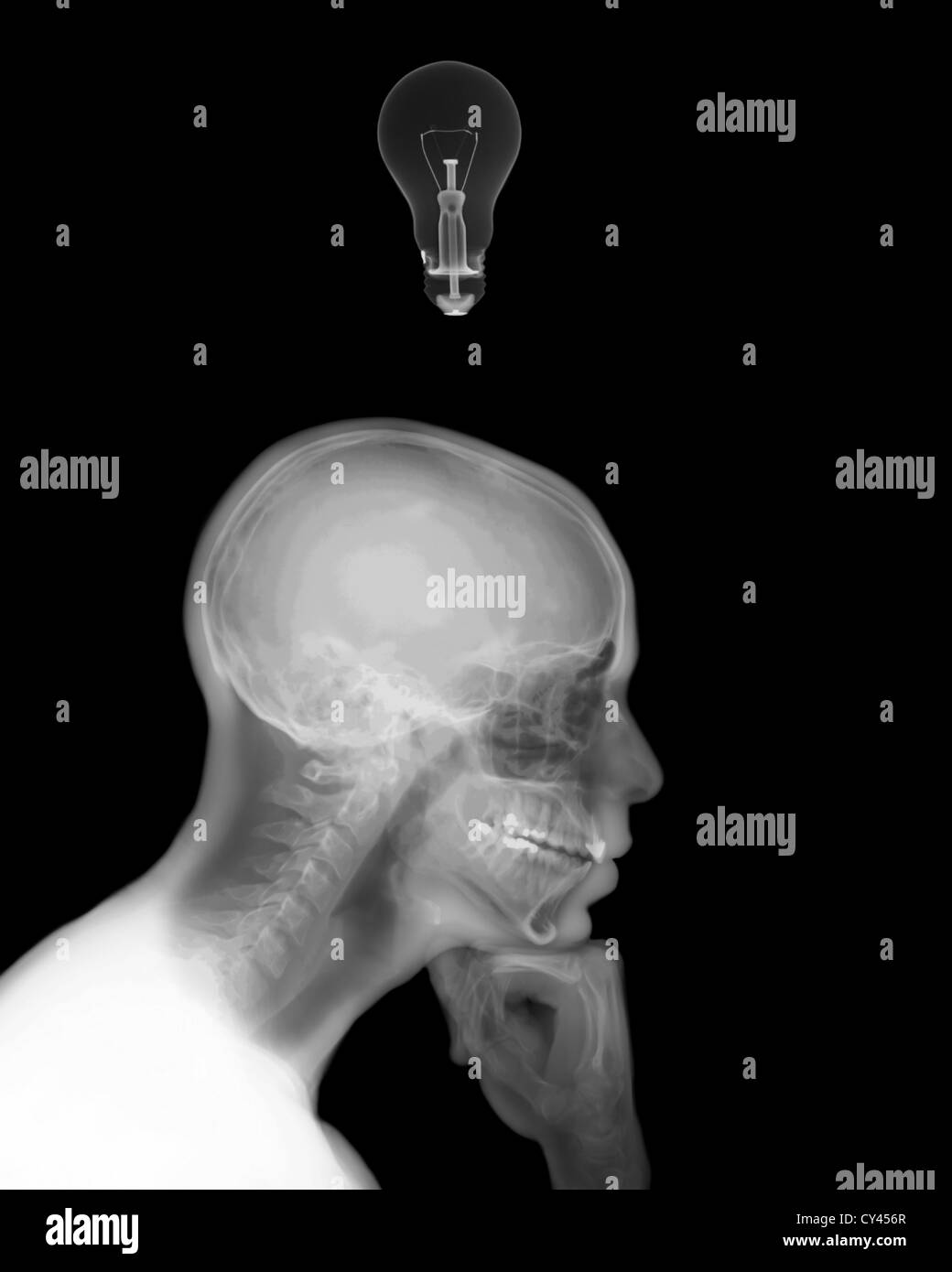 X-ray del pensiero di un uomo con una lampadina elettrica Foto Stock