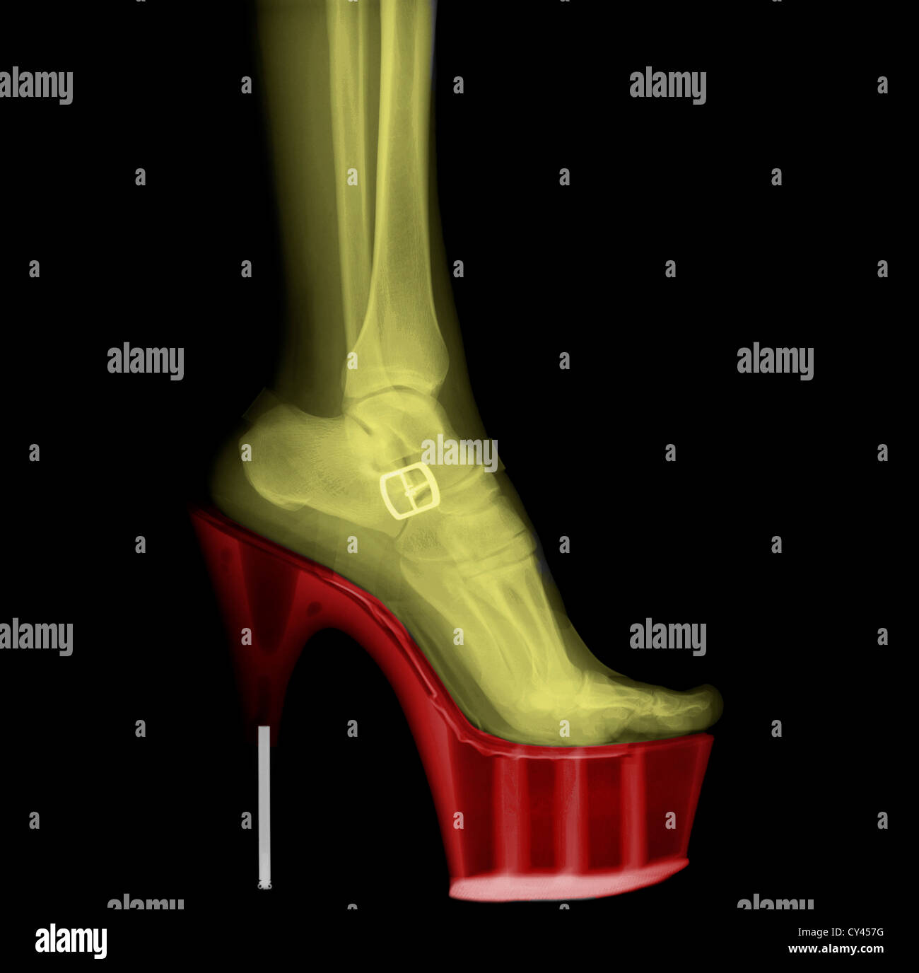 Colorato X-ray di una donna che indossa la gamba Stiletto High-Heeled Scarpa Foto Stock