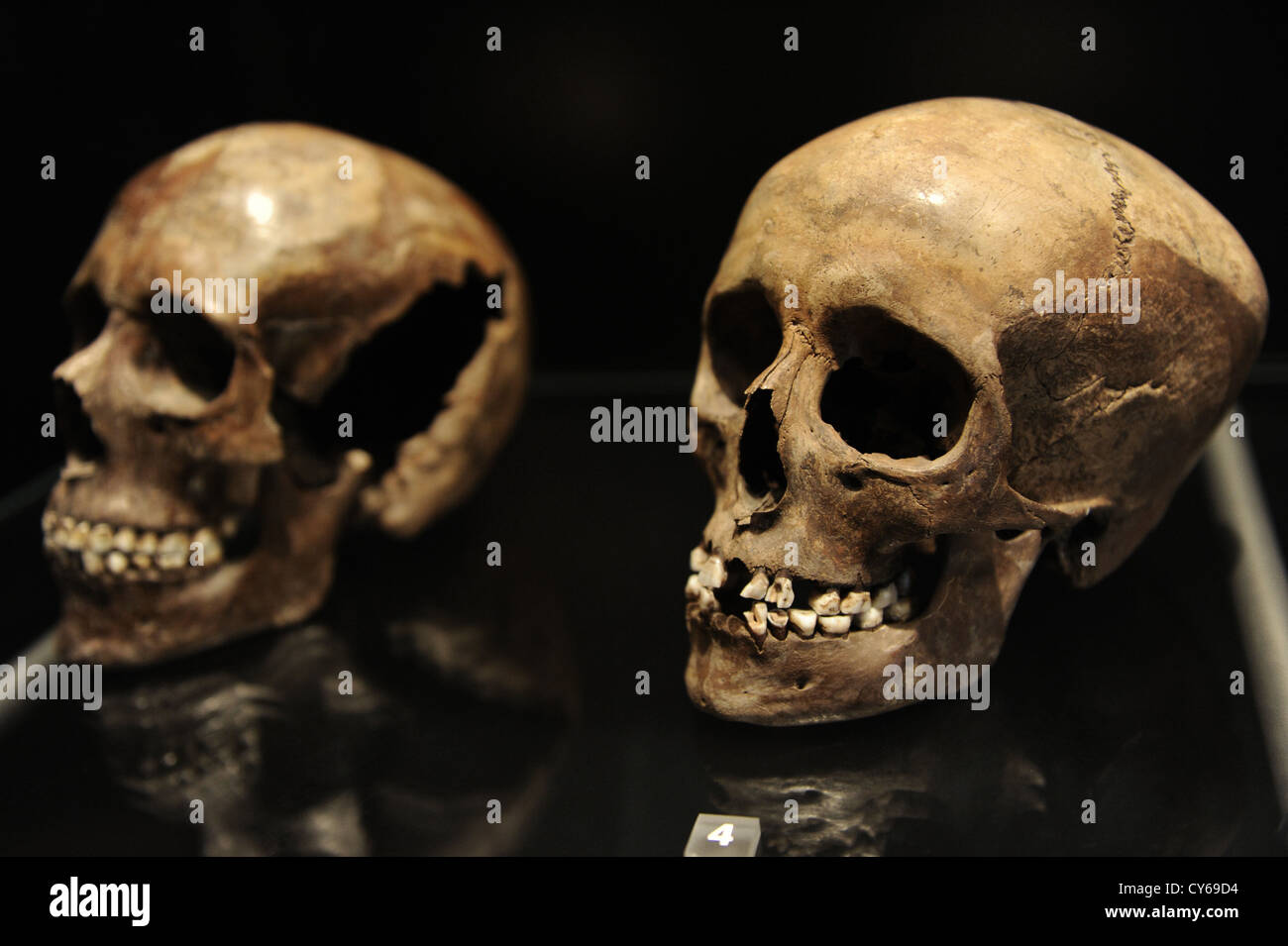 Cranio di una giovane ragazza. 18-20 anni. 3500-3400 A.C. Sigersdal Mose Zelanda settentrionale. Museo nazionale di Danimarca. Foto Stock