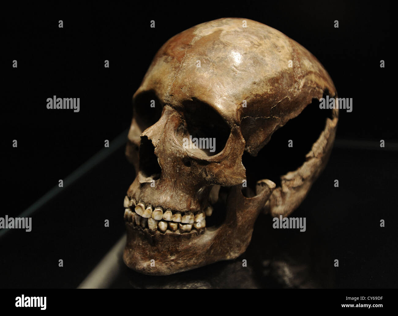 Cranio di una giovane ragazza. 18-20 anni. 3500-3400 A.C. Sigersdal Mose Zelanda settentrionale. Museo nazionale di Danimarca. Foto Stock
