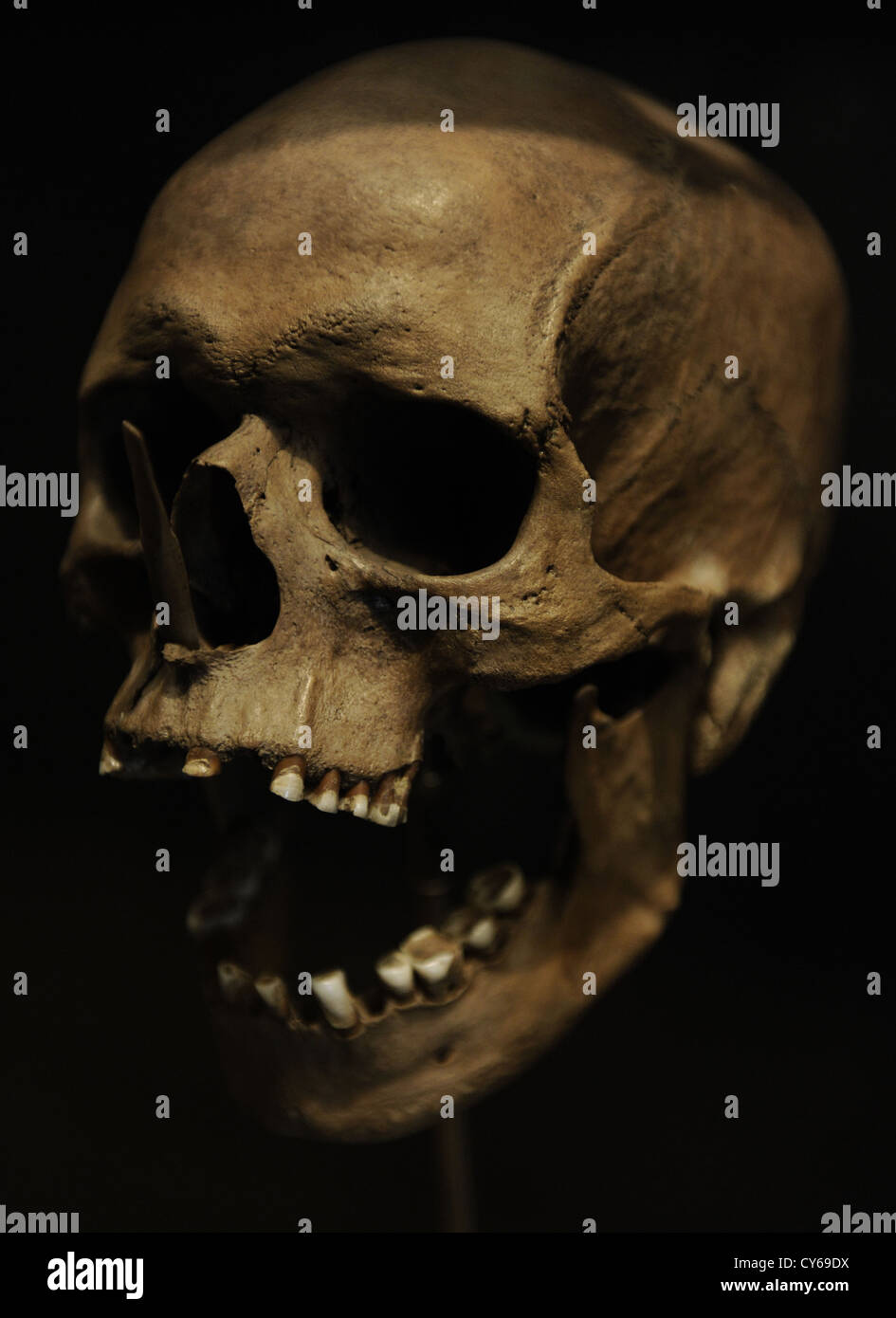 Cranio di un uomo 35-40 anni ucciso con le frecce di osso. 3500 BC. Porsmose, sud della Zelanda. Museo nazionale di Danimarca. Foto Stock