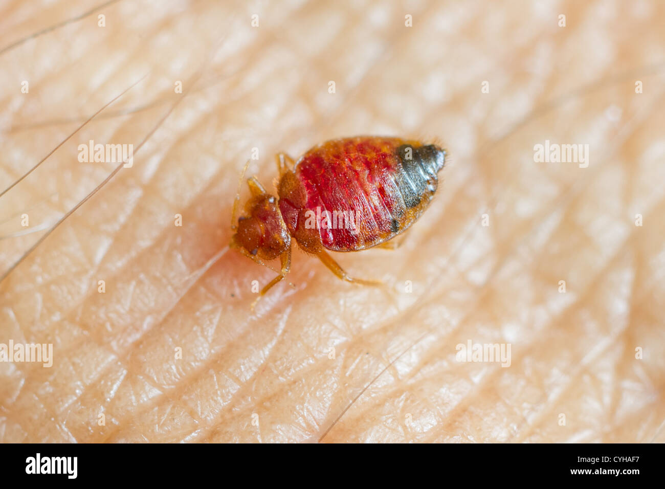 Bed bug alimentazione su pelle umana Foto Stock