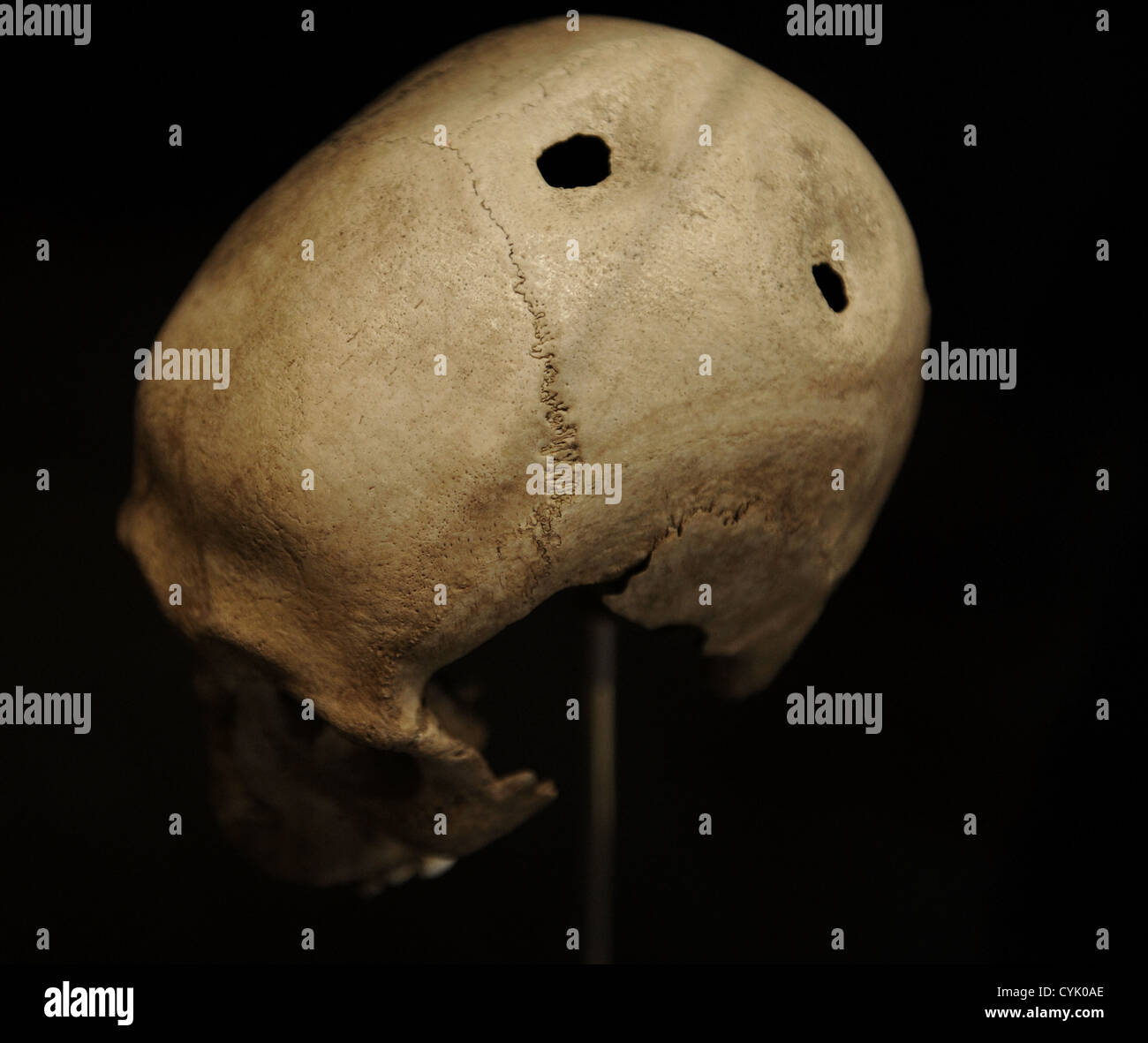 Cranio trapanato di un uomo. 21-35 anni. 3500-3400 A.C. Da Dojringe Mose Zelanda. Museo nazionale di Danimarca. Foto Stock