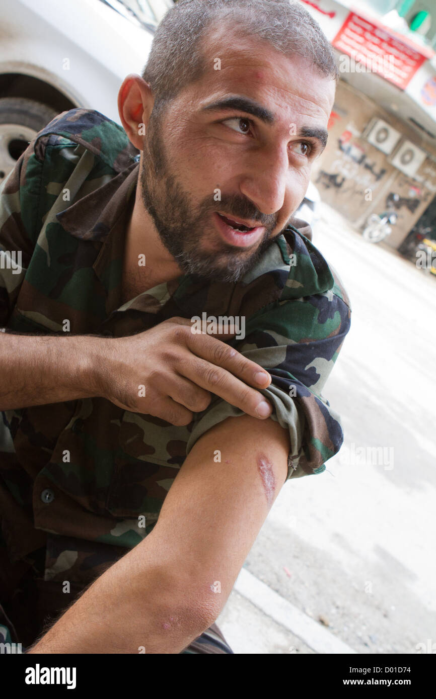 Ottobre 22, 2012 - Aleppo, Siria: un libero esercito siriano fighters visualizza una cicatrice da am pregiudizio. Foto Stock