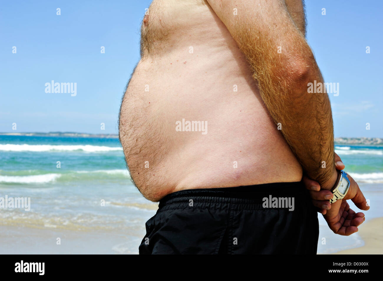 Uomo grasso sulla spiaggia che mostra il suo ventre malsano Foto Stock