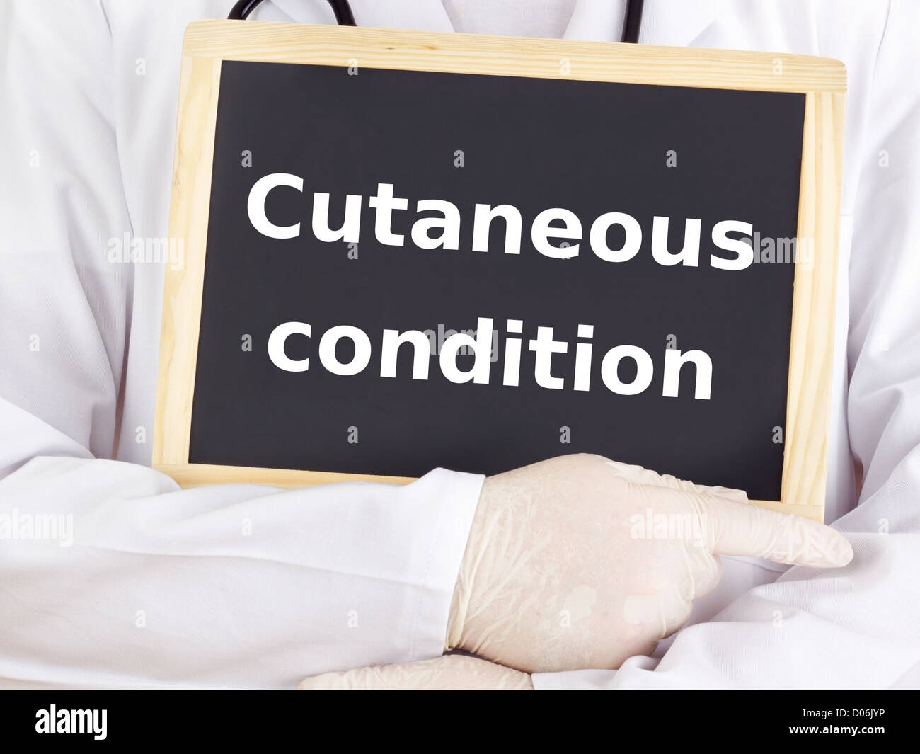 Medico mostra informazioni: condizione cutanea Foto Stock