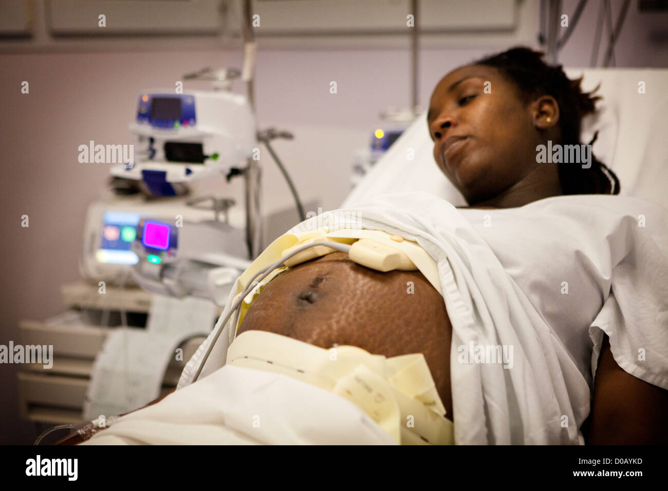 Monitoraggio fetale Foto Stock