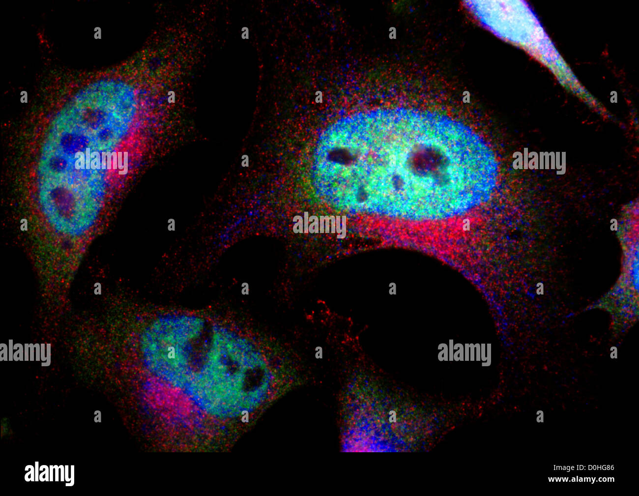 Cellule immortali: cellule HeLa, vista microscopico Foto Stock
