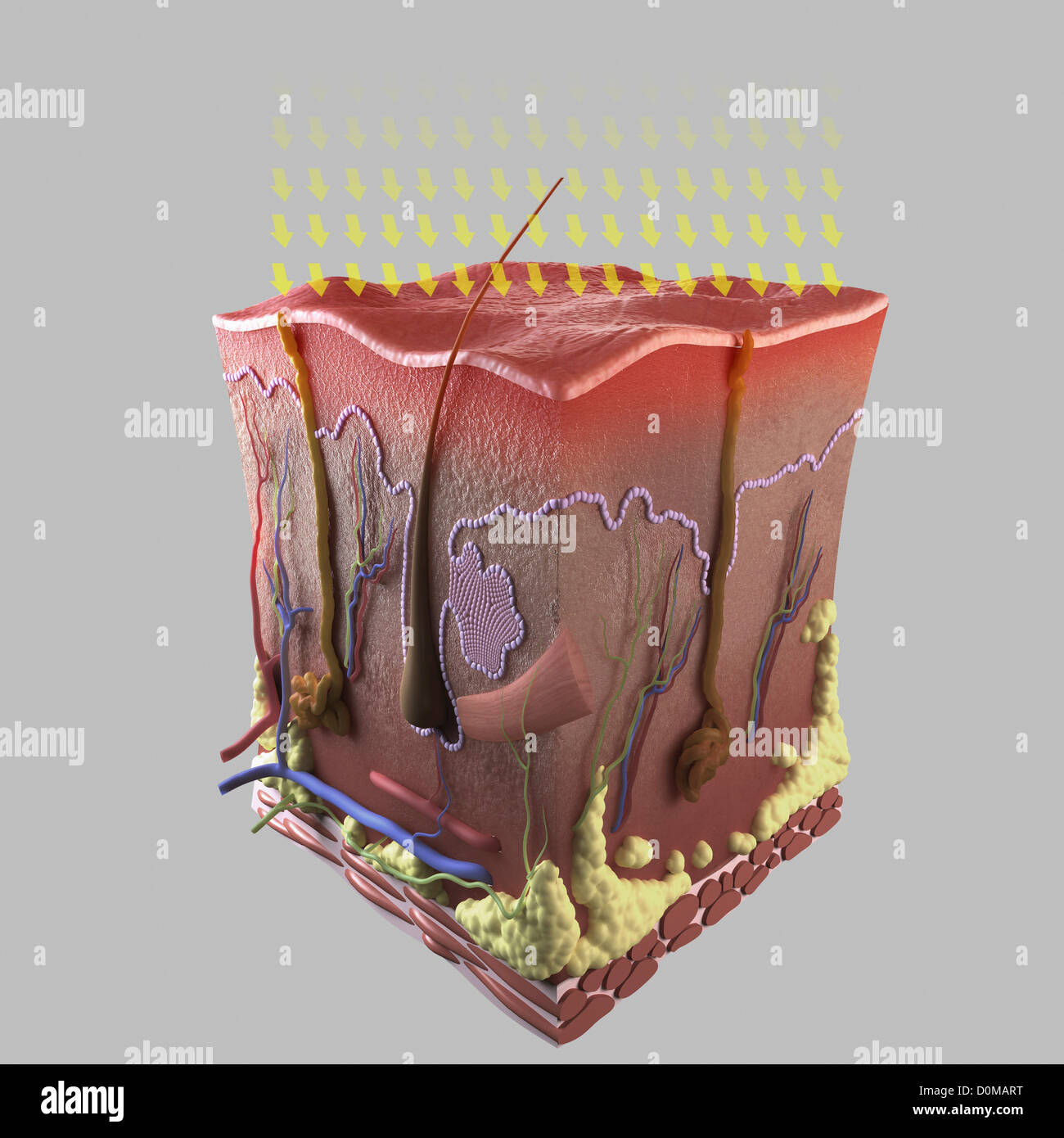 Sezione trasversale della Pelle che mostra gli effetti della radiazione UV per la strato di epidermide. Foto Stock