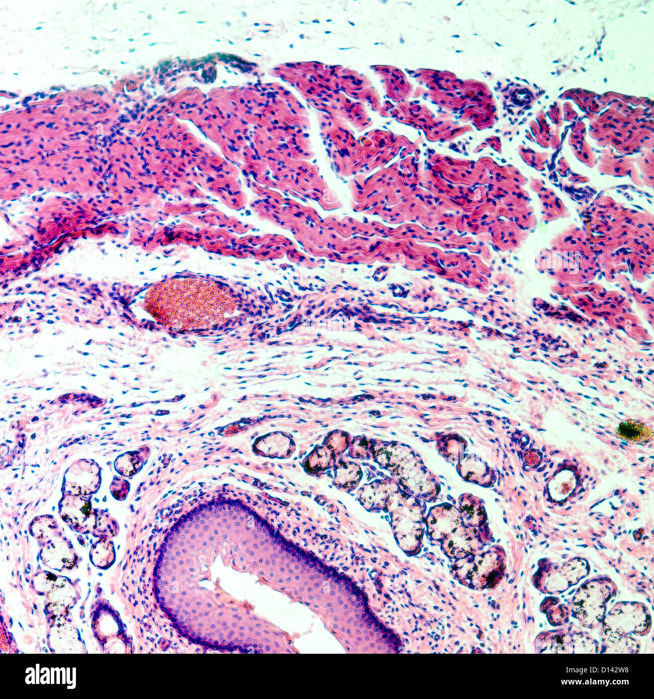 Micrografia di scienza medica epitelio squamoso stratificato della cellula di tessuto Foto Stock