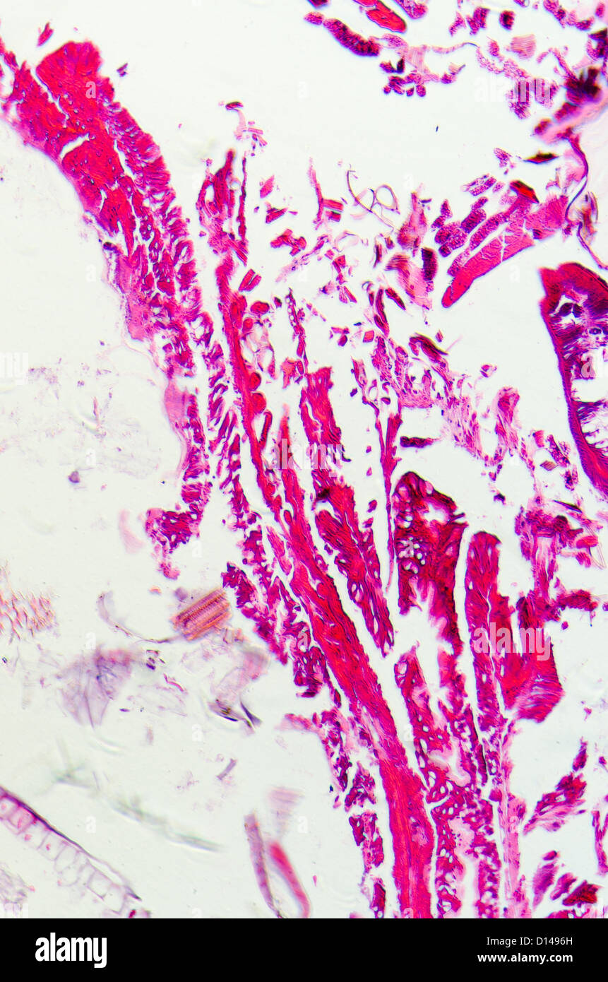 La scienza micrografia di insetti di corpo di sezione trasversale, moth caterpillar prodenia litura, con lui il colorante. Foto Stock