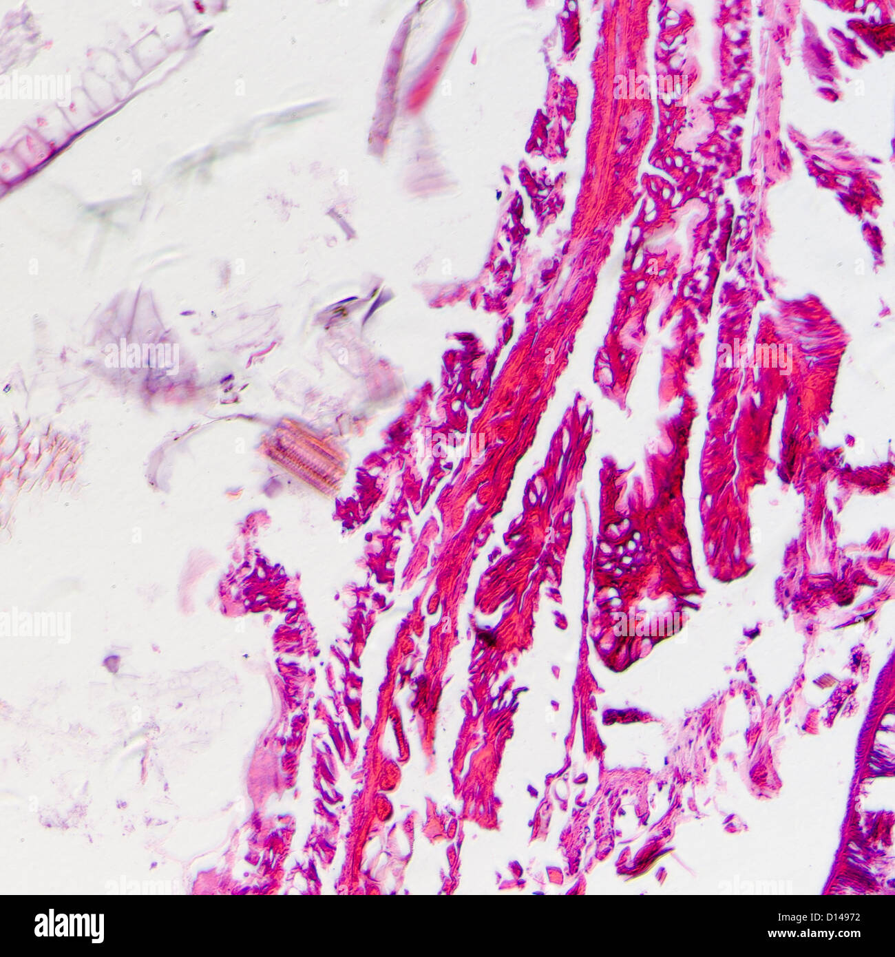 La scienza micrografia di insetti di corpo di sezione trasversale, moth caterpillar prodenia litura, con lui il colorante. Foto Stock