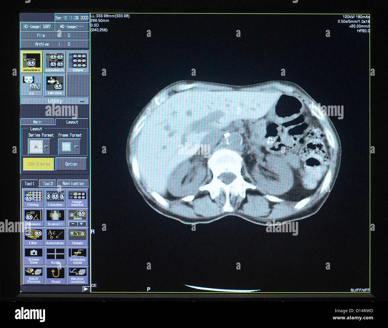 Cervello immagini di scansione Foto Stock