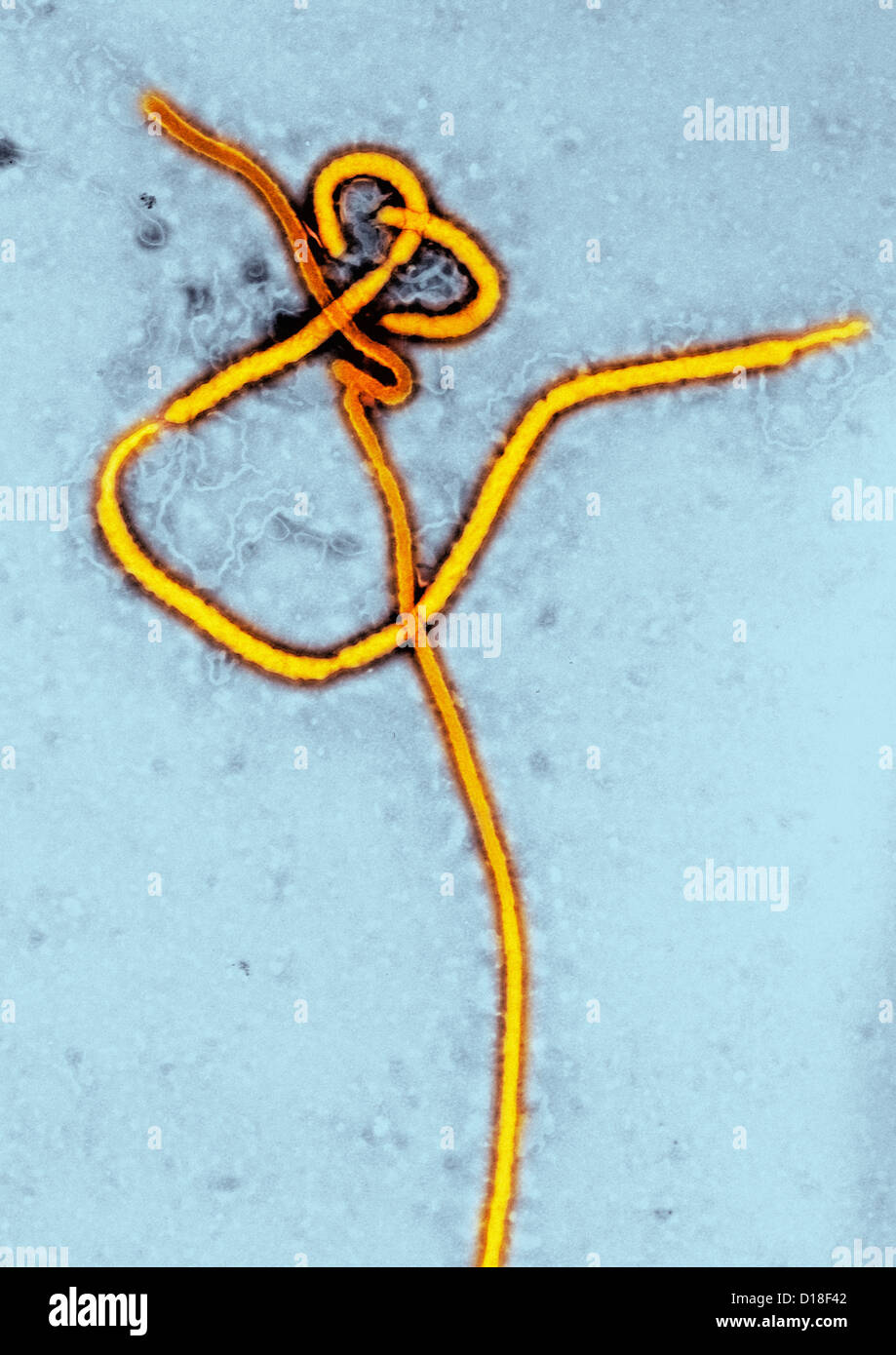 Microscopio elettronico a trasmissione del virus Ebola Foto Stock