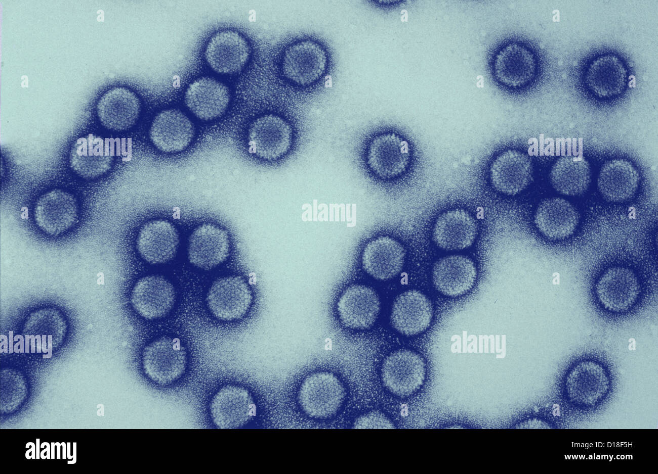 Micrografia elettronica di adenovirus equina Foto Stock