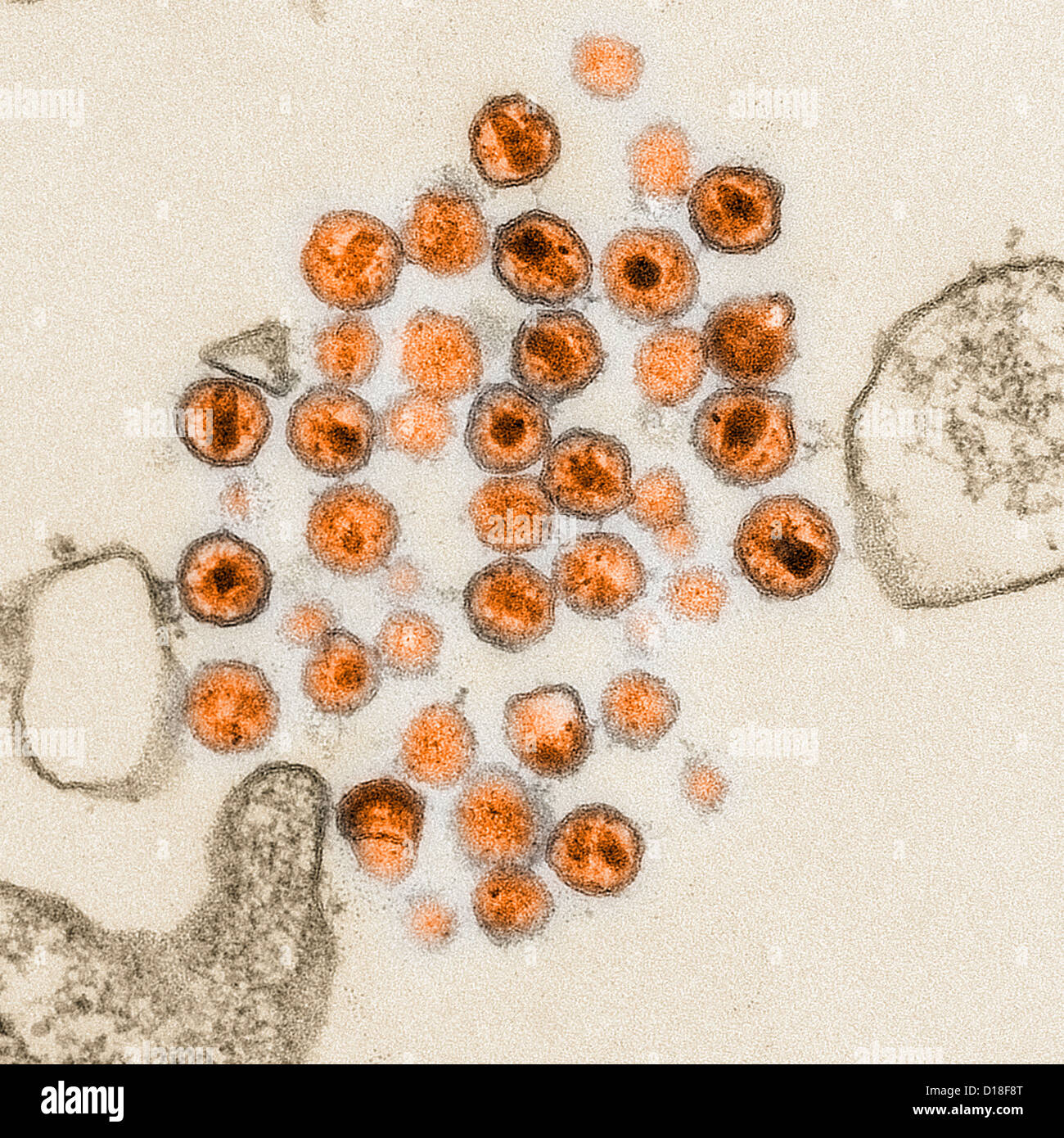 Micrografia elettronica di virus HIV Foto Stock