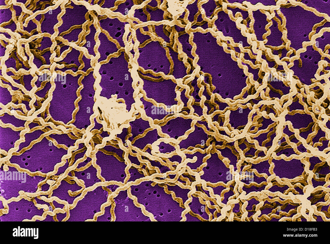 Micrografia al microscopio elettronico a scansione, Leptospira batteri Foto Stock