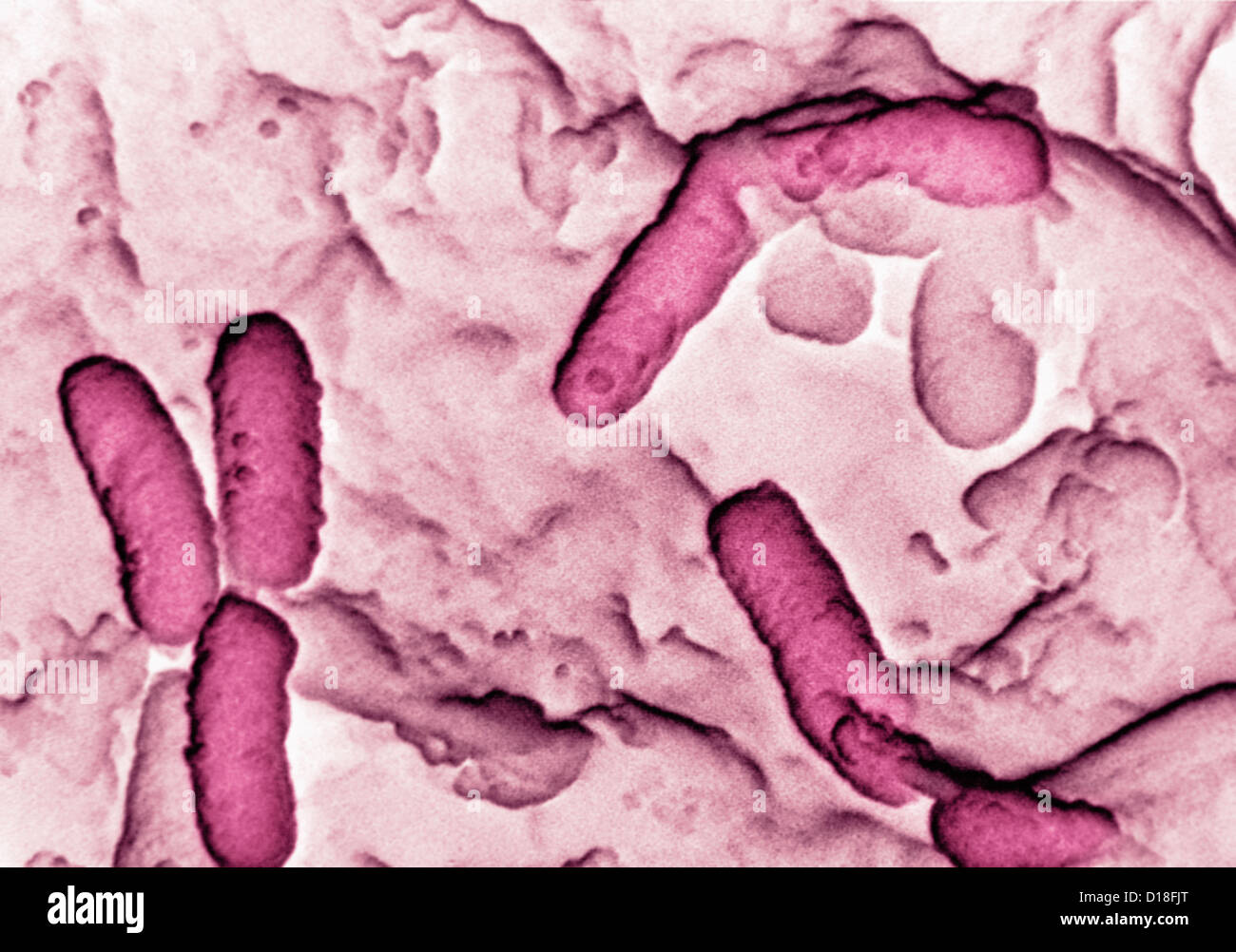 Micrografia elettronica di Pseudomonas aeruginosa Foto Stock