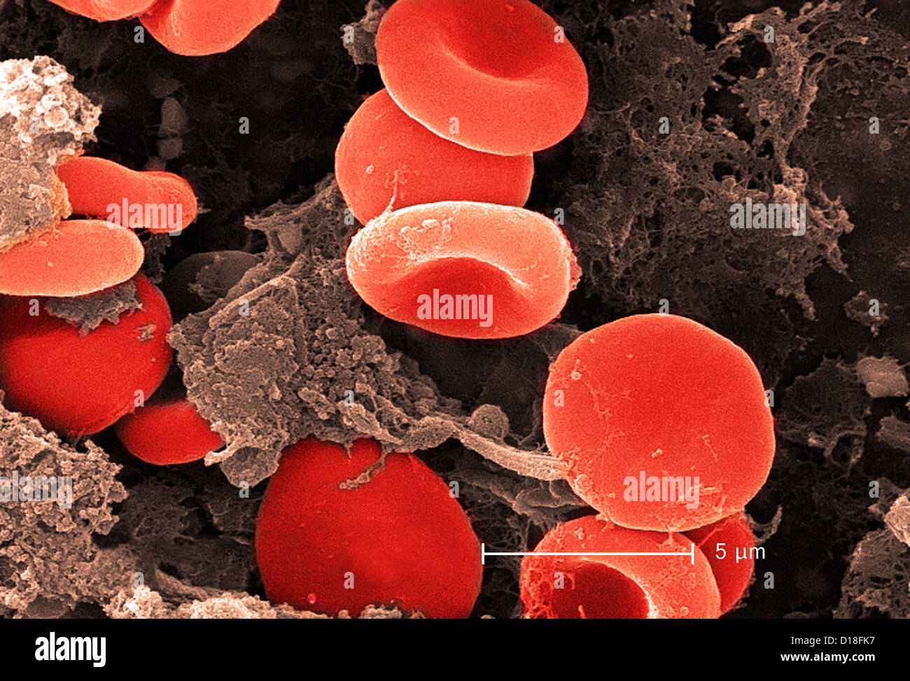 Micrografia elettronica di cellule rosse del sangue e fibrina Foto Stock