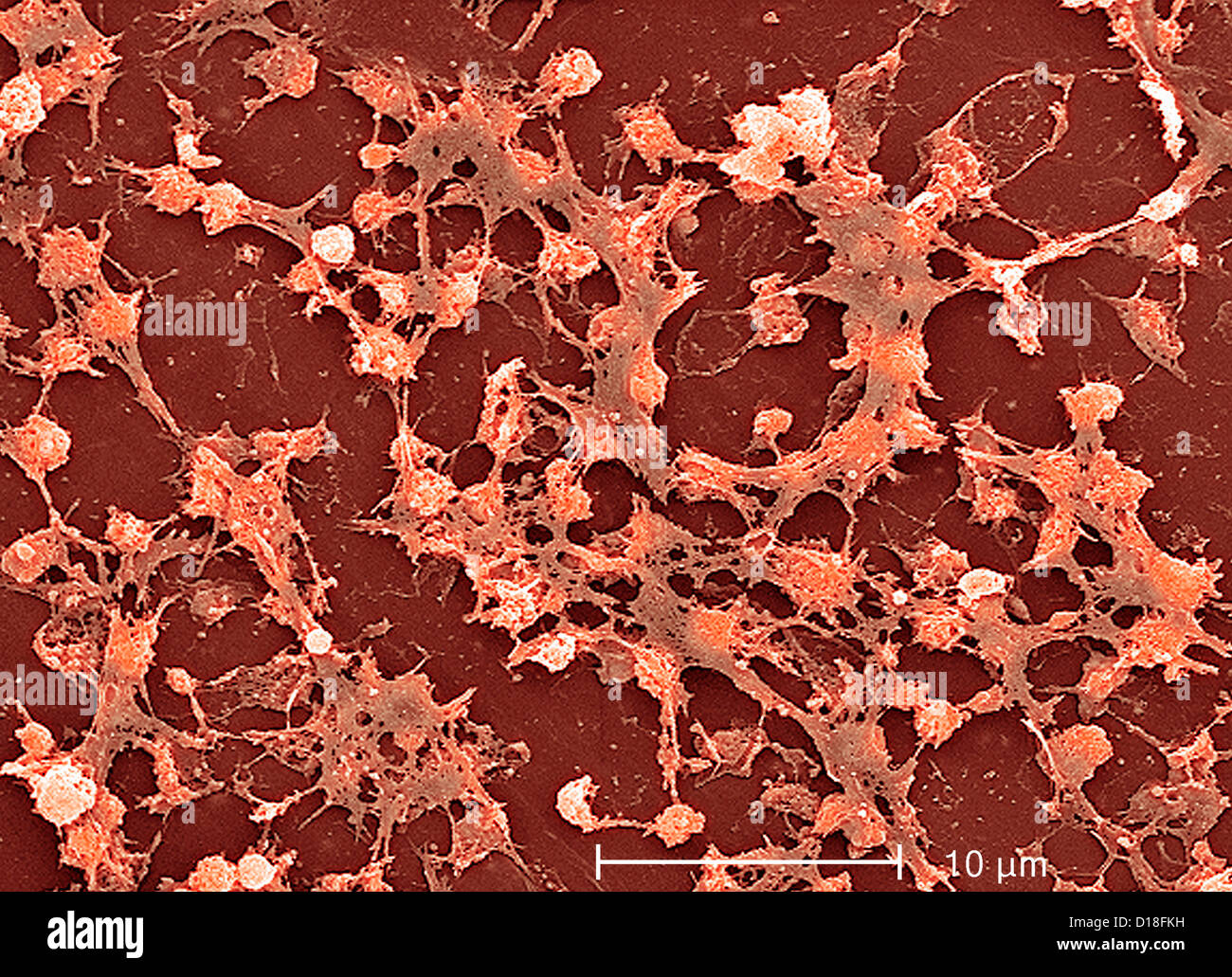 Micrografia elettronica di Staphylococcus aureus Foto Stock