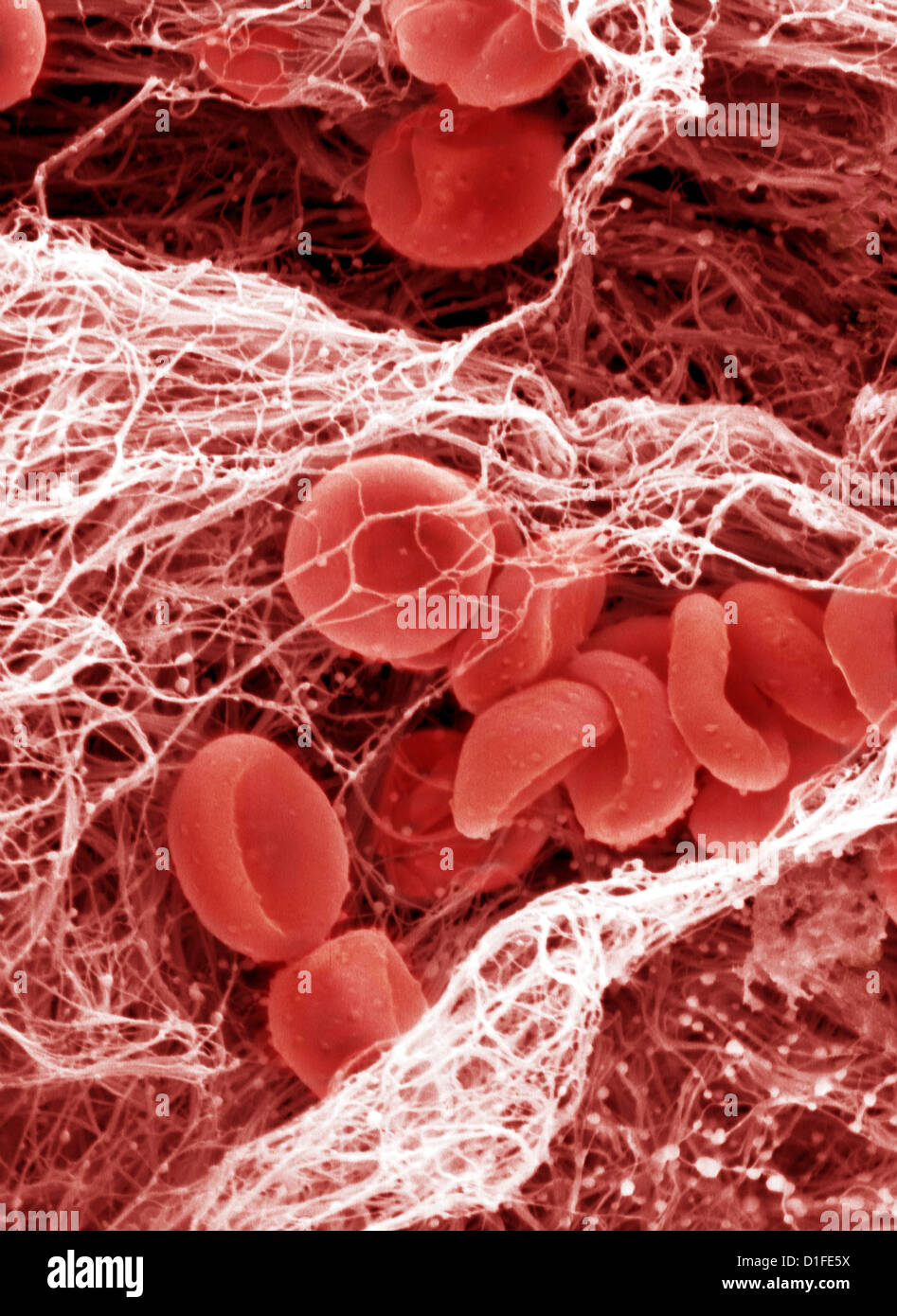 SEM X4000- di coagulo di sangue Foto Stock
