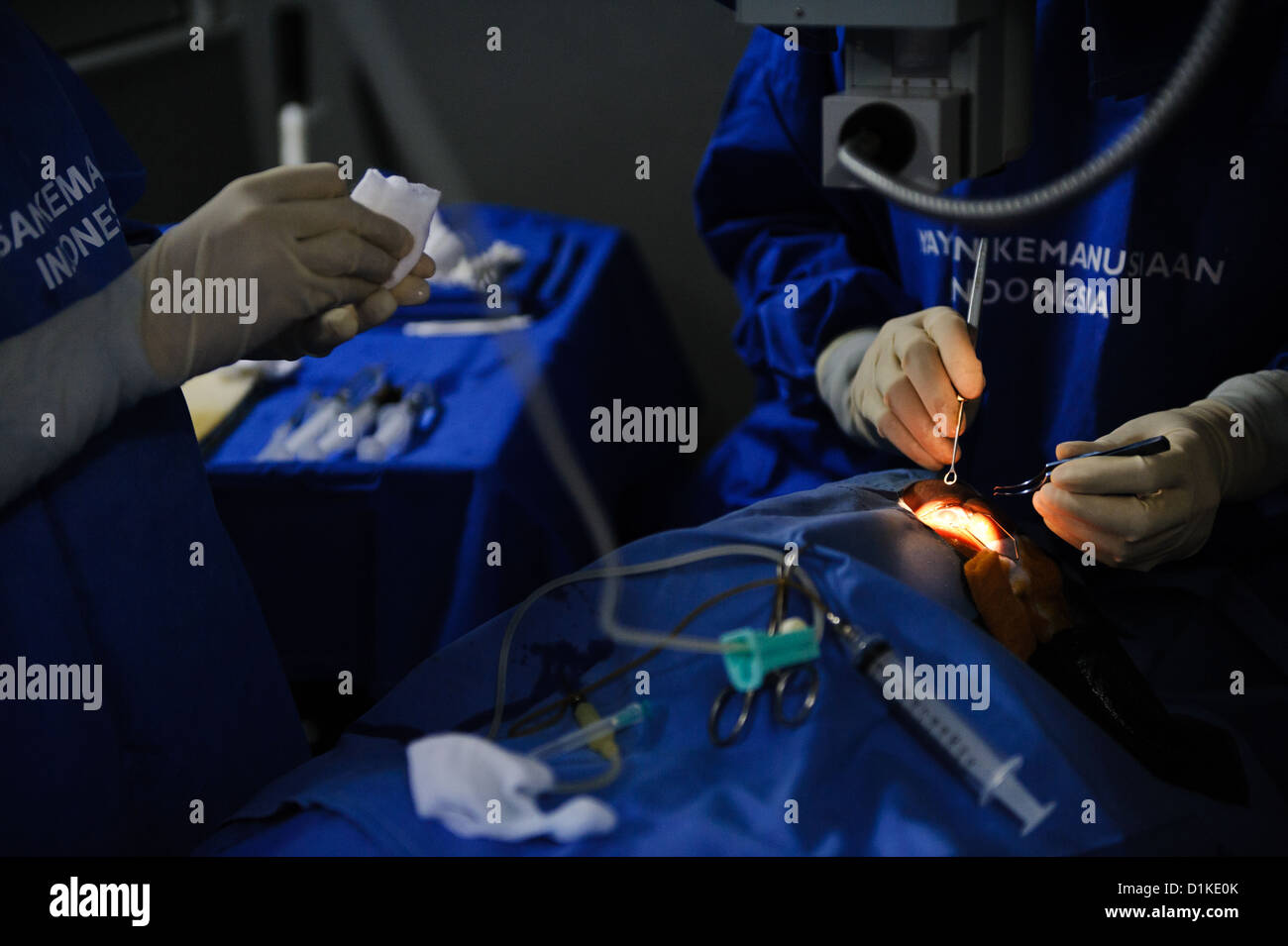 Un paziente sottoposto a chirurgia della cataratta in una clinica mobile, Bali, Indonesia. Foto Stock