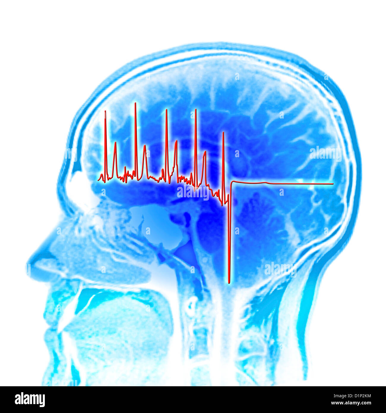 Il tracciato ECG e cervello MRI scan, artwork Foto Stock