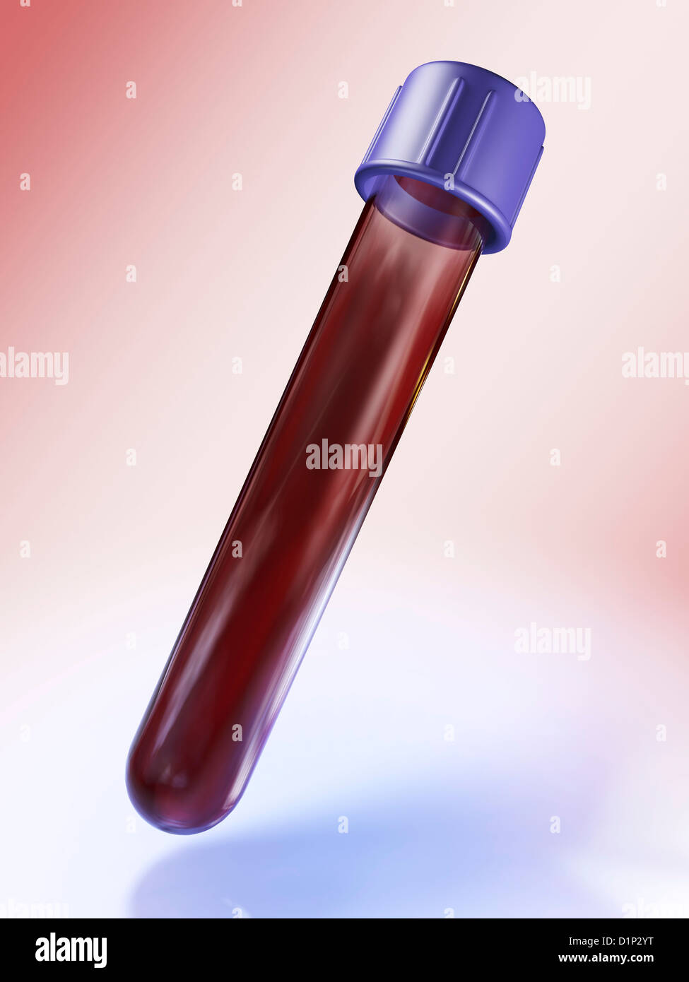 Medical provetta con sangue, artwork Foto Stock
